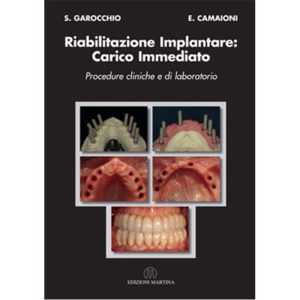 RIABILITAZIONE IMPLANTARE: CARICO IMMEDIATO - Procedure cliniche e di laboratorio